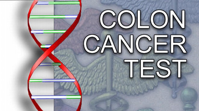 colon cancer crop.jpg